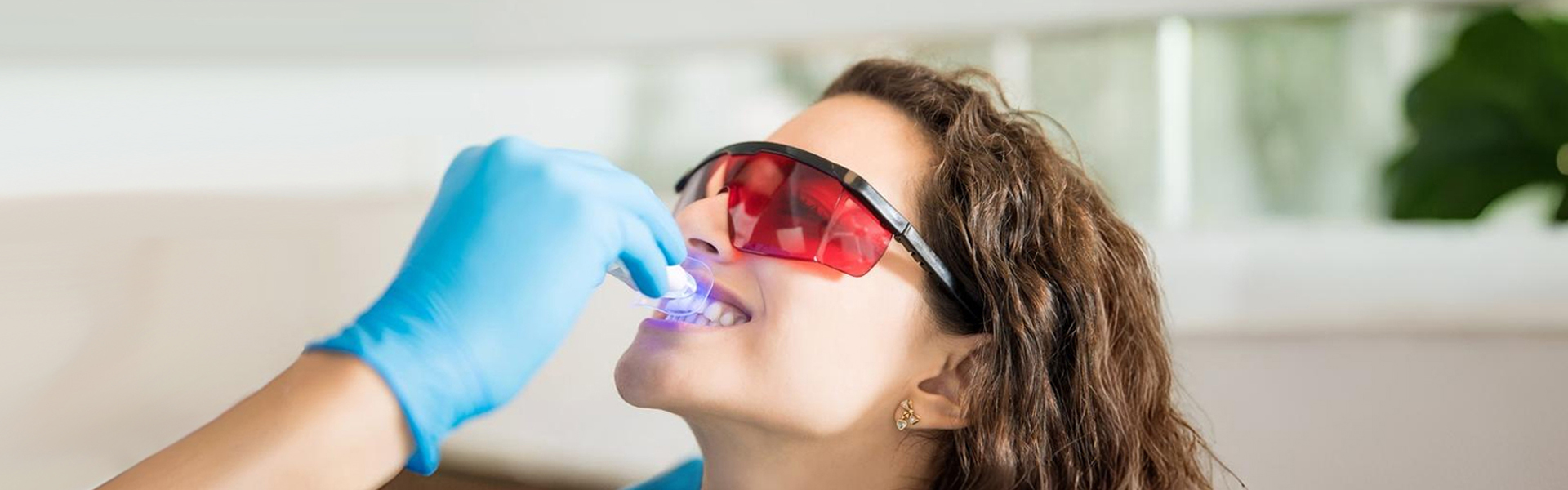 Professional Teeth Whitening Quick, Effective, and Safe Results