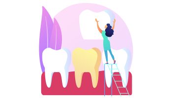 Dental Crowns: Exploring Materials for Strength and Aesthetics
